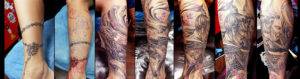 Tapado de un tatuaje